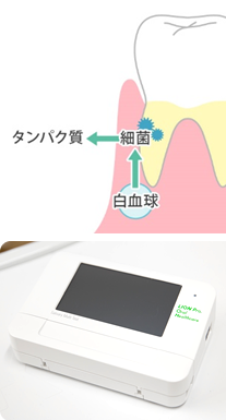 予防歯科｜にしい歯科クリニック｜大阪市中央区の高麗橋にある歯科・歯医者